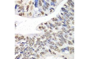 Immunohistochemistry of paraffin-embedded human colon using Nono Antibody. (NONO anticorps  (AA 1-300))