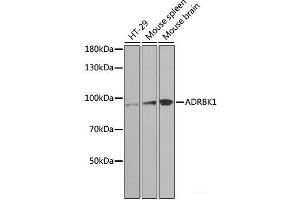 Western blot analysis of extracts of various cell lines using ADRBK1 Polyclonal Antibody at dilution of 1:1000. (GRK2 anticorps)