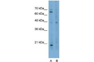 Host:  Rabbit  Target Name:  STAU1  Sample Type:  HepG2  Lane A:  Primary Antibody  Lane B:  Primary Antibody + Blocking Peptide  Primary Antibody Concentration:  2. (STAU1/Staufen anticorps  (N-Term))