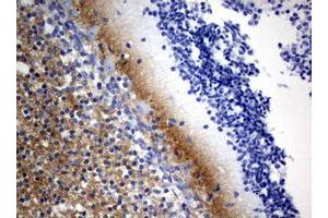 Image no. 3 for anti-Visinin-Like 1 (VSNL1) (AA 2-191) antibody (ABIN1491124)