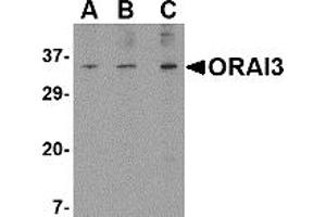 Image no. 1 for anti-ORAI Calcium Release-Activated Calcium Modulator 3 (ORAI3) (N-Term) antibody (ABIN203697) (ORAI3 anticorps  (N-Term))