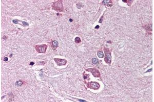 Human Brain, Cortex (formalin-fixed, paraffin-embedded) stained with PTPN11 antibody ABIN214466 at 5 ug/ml followed by biotinylated goat anti-rabbit IgG secondary antibody ABIN481713, alkaline phosphatase-streptavidin and chromogen. (PTPN11 anticorps  (N-Term))