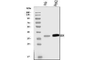 Western blot analysis of GGH using anti-GGH antibody (ABIN7600902).