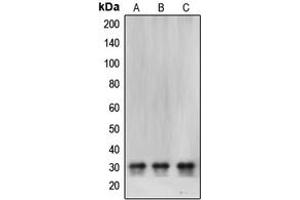 Western blot analysis of CBR1 expression in SHSY5Y (A), HeLa (B), MCF7 (C) whole cell lysates. (CBR1 anticorps  (Center))