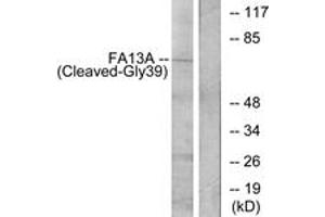 Western blot analysis of extracts from Jurkat cells, treated with etoposide 25uM 24h, using FA13A (Cleaved-Gly39) Antibody. (FA13A (AA 20-69), (Cleaved-Gly39) anticorps)