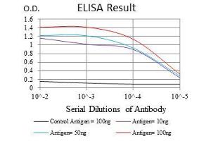Black line: Control Antigen (100 ng), Purple line: Antigen(10 ng), Blue line: Antigen (50 ng), Red line: Antigen (100 ng), (NEFL anticorps)