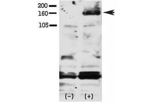 Western blot testing of phospho-HER4 antibody and FG pancreatic carcinoma cells treated with or without EGF (50ng/ml) for 15 min. (ERBB4 anticorps  (pTyr1188))