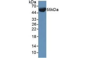 Western blot analysis of Mouse Serum. (Involucrin anticorps  (AA 301-460))