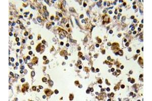 Immunohistochemistry analyzes of MSK1 antibody in paraffin-embedded human lymph node tissue. (MSK1 anticorps)