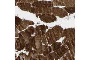 Immunohistochemical staining of human skeletal muscle with FLII polyclonal antibody  shows strong cytoplasmic positivity in myocytes at 1:20-1:50 dilution. (FLII anticorps)