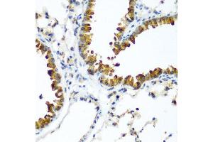 Immunohistochemistry of paraffin-embedded mouse lung using WWTR1 antibody at dilution of 1:200 (40x lens). (WWTR1 anticorps)
