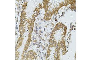 Immunohistochemistry of paraffin-embedded human stomach using CYBB antibody. (CYBB anticorps)