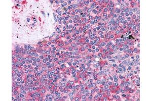 Anti-LST1 antibody IHC of human spleen. (LST1 anticorps)