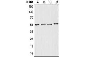 Western blot analysis of RTN4R expression in K562 (A), MCF7 (B), mouse brain (C), rat brain (D) whole cell lysates.
