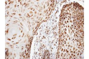 IHC-P Image Immunohistochemical analysis of paraffin-embedded BCC3 xenograft, using COX6B1, antibody at 1:100 dilution.