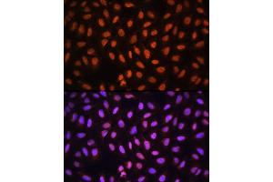Immunofluorescence analysis of U-2 OS cells using MCM5 Rabbit pAb (ABIN6132074, ABIN6143644, ABIN6143646 and ABIN6217542) at dilution of 1:100 (40x lens). (MCM5 anticorps  (AA 1-230))
