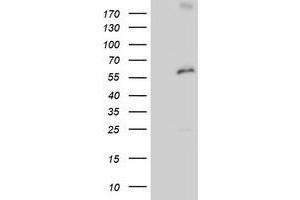 Western Blotting (WB) image for anti-Proteasome (Prosome, Macropain) 26S Subunit, Non-ATPase, 3 (PSMD3) antibody (ABIN1499979) (PSMD3 anticorps)