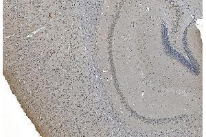 IHC analysis of LSM7 using anti-LSM7 antibody (ABIN7598937). (LSM7 anticorps  (AA 1-103))