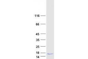 Validation with Western Blot (CXCL10 Protein (Myc-DYKDDDDK Tag))