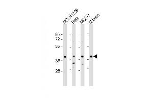All lanes : Anti-TWF1 Antibody (Center) at 1:2000 dilution Lane 1: NCI- whole cell lysate Lane 2: Hela whole cell lysate Lane 3: MCF-7 whole cell lysate Lane 4: mouse brain lysate Lysates/proteins at 20 μg per lane. (TWF1 anticorps  (AA 201-235))