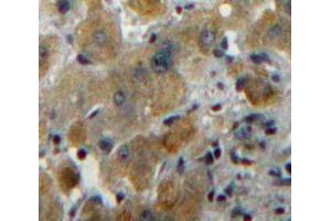 Used in DAB staining on fromalin fixed paraffin-embedded Liver tissue (MUC6 anticorps  (AA 2338-2439))