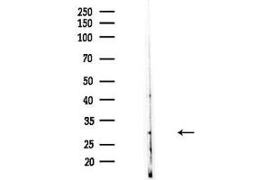 anti-Ribosomal Protein S6 (RPS6) (C-Term) antibody