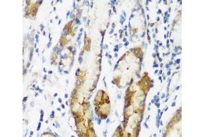Immunohistochemistry of paraffin-embedded Human gastric using NAA60 Polyclonal Antibody at dilution of 1:200 (40x lens). (NAT15 anticorps)