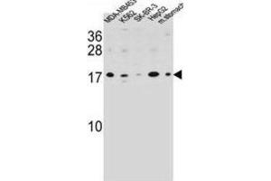 Western Blotting (WB) image for anti-S100 Calcium Binding Protein Z (S100Z) antibody (ABIN2995739) (S100Z anticorps)
