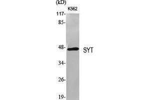 Western Blot (WB) analysis of specific cells using SYT Polyclonal Antibody.