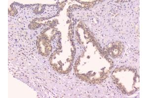 IHC analysis of TNFRSF11B using anti-TNFRSF11B antibody (ABIN7600875).