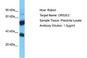 Host: Rabbit Target Name: OR52E2 Sample Type: Placenta lysates Antibody Dilution: 1. (OR52E2 anticorps  (C-Term))