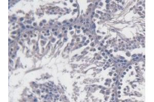 anti-Cysteine-Rich Secretory Protein 1 (CRISP1) (AA 20-244) antibody