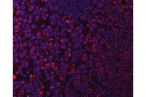 IF analysis of SUCLG1 using anti-SUCLG1 antibody (ABIN7600906). (SUCLG1 anticorps  (AA 25-346))