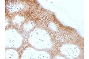 IHC testing of FFPE human skin with Desmoglein 1 antibody (clone DSG1/1733). (Desmoglein 1 anticorps  (Internal Region))