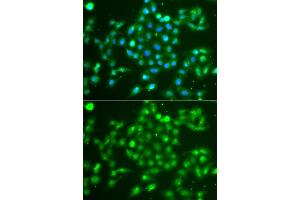 Immunofluorescence analysis of  cells using UCHL5 antibody (ABIN6132764, ABIN6149872, ABIN6149874 and ABIN6223990). (UCHL5 anticorps  (AA 1-328))