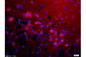 Formalin-fixed and paraffin-embedded rat brain labeled with Anti-KMT8/Riz1/Riz2 Polyclonal Antibody, Unconjugated (ABIN763001) 1:200, overnight at 4°C, The secondary antibody was Goat Anti-Rabbit IgG, Cy3 conjugated used at 1:200 dilution for 40 minutes at 37°C. (PRDM2 anticorps  (AA 1201-1300))
