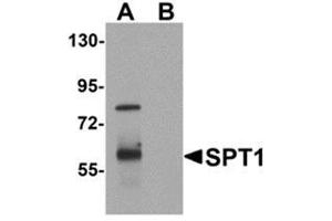 Western blot analysis of TYW1 in human lung tissue lysate with TYW1 antibody at 1 μg/ml. (TYW1 anticorps  (C-Term))