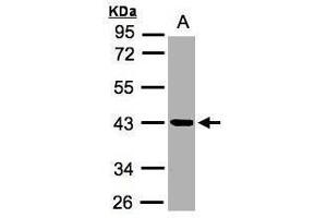 WB Image Sample (30μg whole cell lysate) A:MOLT4 , 10% SDS PAGE antibody diluted at 1:2000 (Kallikrein 11 anticorps)