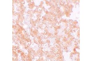 Immunohistochemical staining of rat lung cells with MFSD2 polyclonal antibody  at 5 ug/mL. (MFSD2A anticorps  (C-Term))