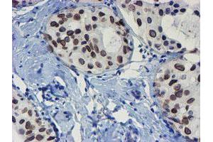 Image no. 7 for anti-SUMO1/sentrin/SMT3 Specific Peptidase 2 (SENP2) (AA 139-523) antibody (ABIN1490926) (SENP2 anticorps  (AA 139-523))