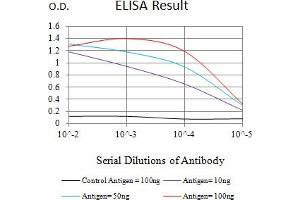 Black line: Control Antigen (100 ng),Purple line: Antigen (10 ng), Blue line: Antigen (50 ng), Red line:Antigen (100 ng)