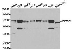 Western Blotting (WB) image for anti-Insulin-Like Growth Factor 2 mRNA Binding Protein 1 (IGF2BP1) antibody (ABIN1873165) (IGF2BP1 anticorps)