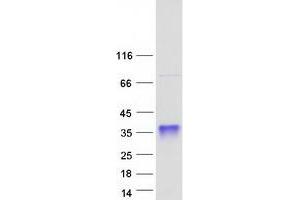 Validation with Western Blot