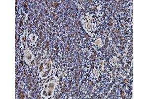IHC analysis of DYNLL1/PIN using anti-DYNLL1/PIN antibody (ABIN7599571).