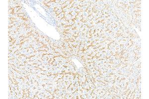 Immunohistochemistry (IHC) image for anti-Epidermal Growth Factor Receptor (EGFR) (C-Term) antibody (ABIN7795642) (Recombinant EGFR anticorps  (C-Term))