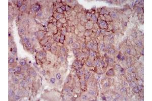Immunohistochemistry (IHC) image for anti-Maternal Embryonic Leucine Zipper Kinase (MELK) antibody (ABIN1108210)