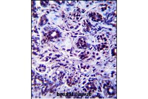 DHX32 Antibody (Center) (ABIN657498 and ABIN2846523) immunohistochemistry analysis in formalin fixed and paraffin embedded human breast tissue followed by peroxidase conjugation of the secondary antibody and DAB staining. (DHX32 anticorps  (AA 342-371))
