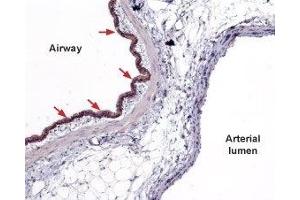 Expression of Sphingosine 1-phosphate receptor 2 in rat lung - Immunohistochemical staining of paraffin embedded rat lung sections using Anti-S1PR2 (EDG5) Antibody (ABIN7043773, ABIN7045272 and ABIN7045273), (1:100). (S1PR2 anticorps  (AA 129-146))