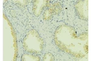 ABIN6272851 at 1/100 staining Mouse colon tissue by IHC-P.