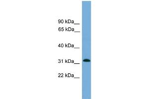 WB Suggested Anti-MRPS2  Antibody Titration: 0. (MRPS2 anticorps  (Middle Region))